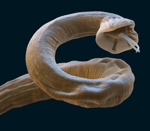 Fatal parasite is now endemic in the UK, experts warn
